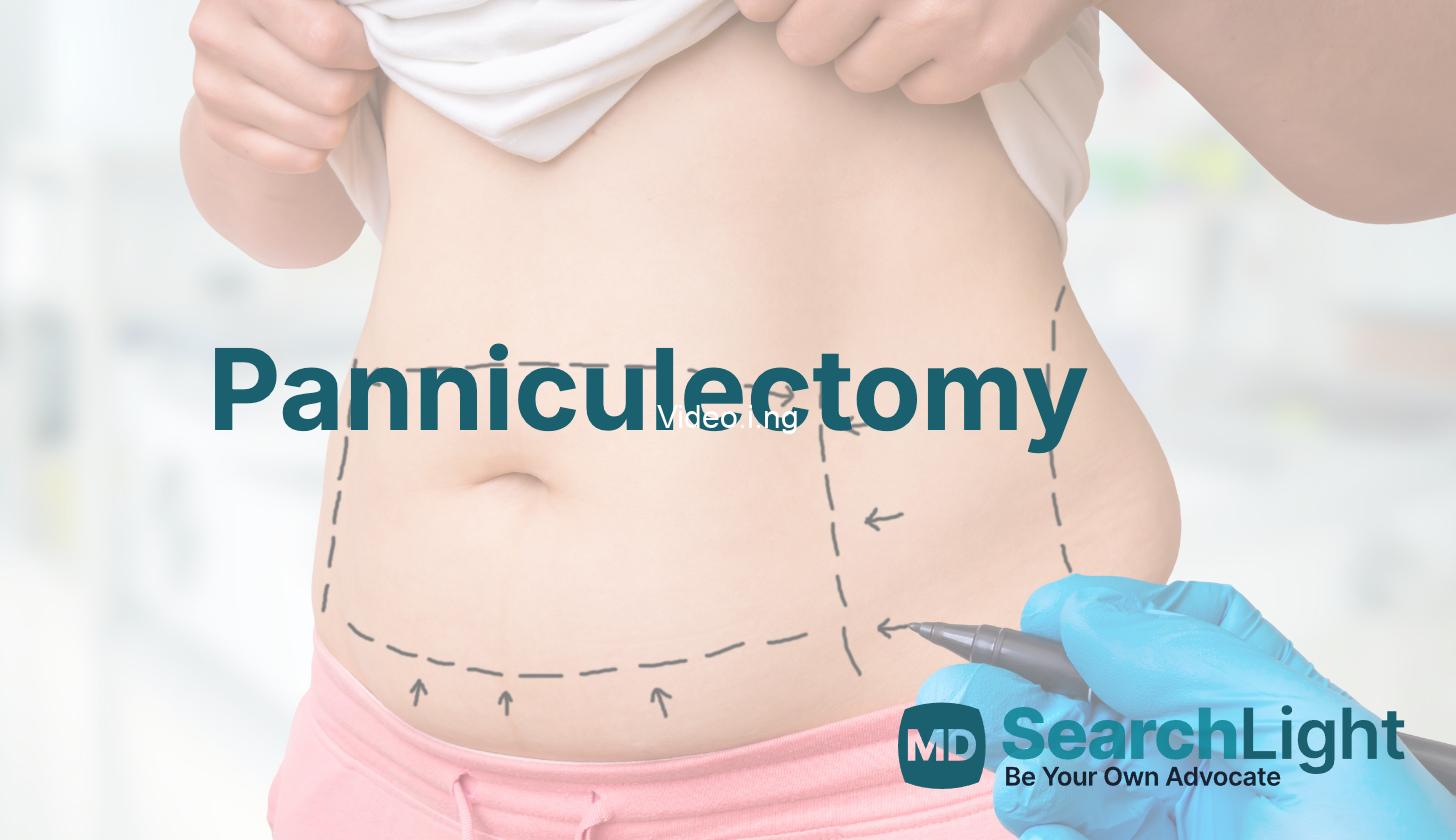 Surgeon’s cloth found inside woman’s abdomen three months after surgery